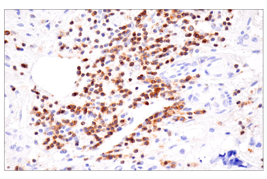 Immunohistochemistry Image 2: SLAMF6/CD352 (E3H1E) XP® Rabbit mAb (BSA and Azide Free)