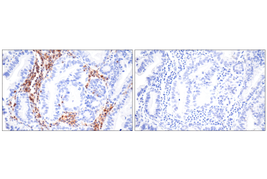 Immunohistochemistry Image 3: SLAMF6/CD352 (E3H1E) XP® Rabbit mAb (BSA and Azide Free)