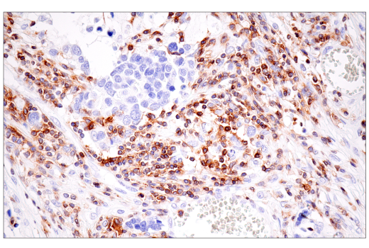 Immunohistochemistry Image 8: SLAMF6/CD352 (E3H1E) XP® Rabbit mAb (BSA and Azide Free)