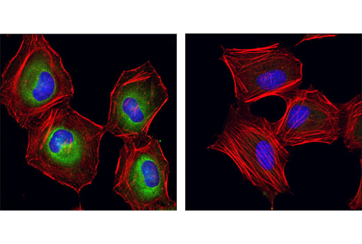 Immunofluorescence Image 1: Phospho-eIF4B (Ser406) Antibody