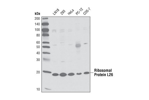 Western Blotting Image 1: Ribosomal Protein L26 (D8F6) Rabbit mAb