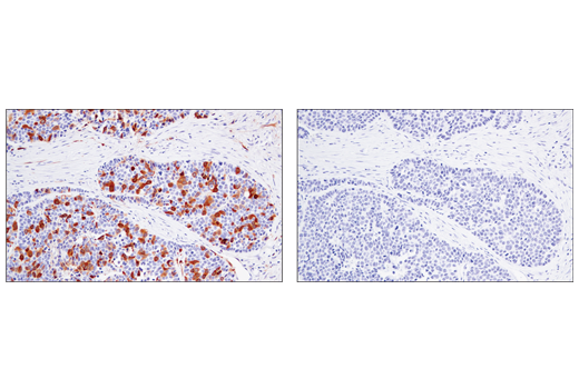 Immunohistochemistry Image 3: RRM2 (E7Y9J) XP® Rabbit mAb (BSA and Azide Free)