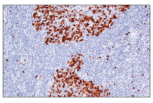Immunohistochemistry Image 5: RRM2 (E7Y9J) XP® Rabbit mAb (BSA and Azide Free)
