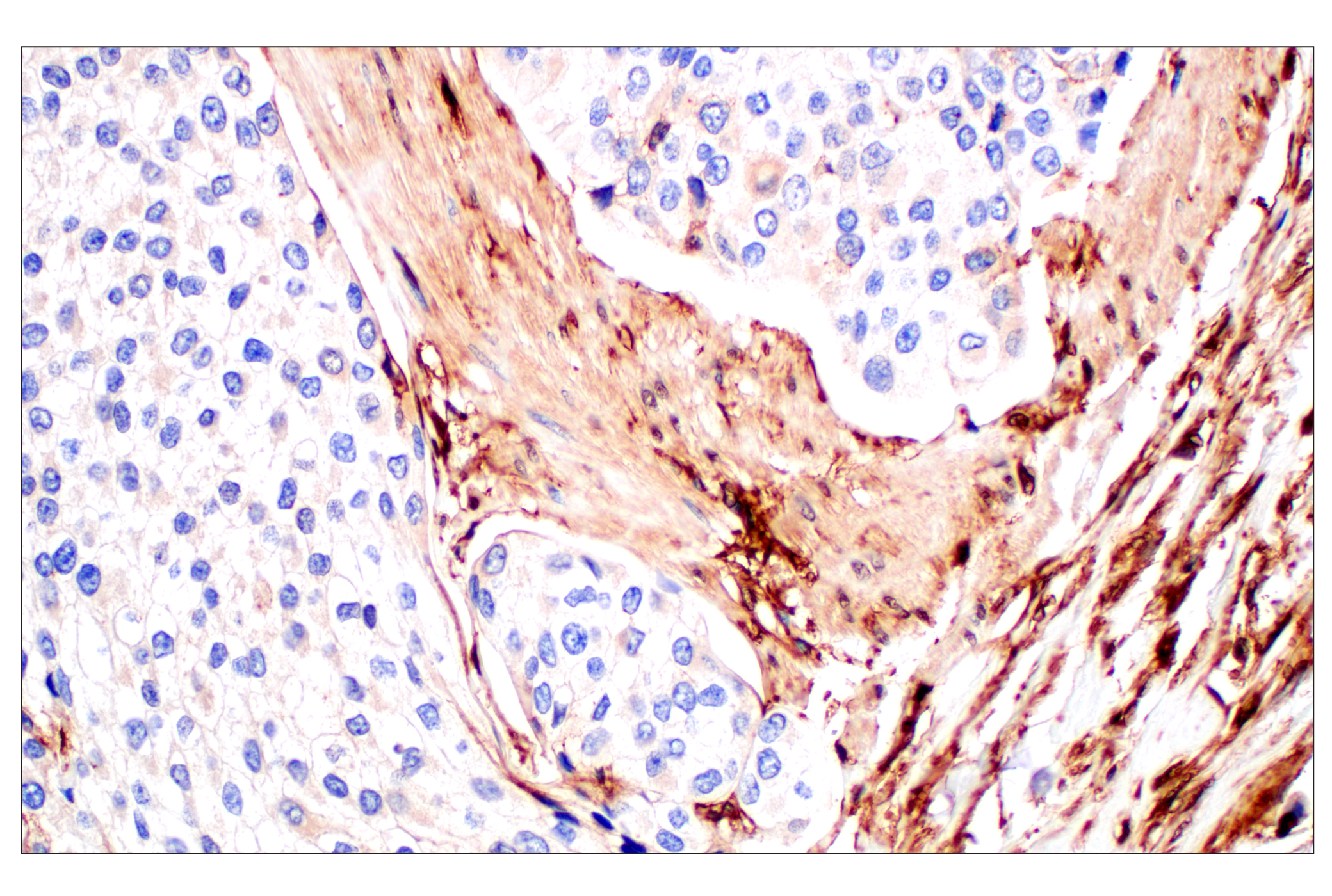 Immunohistochemistry Image 4: Annexin V (E3W8V) Rabbit mAb