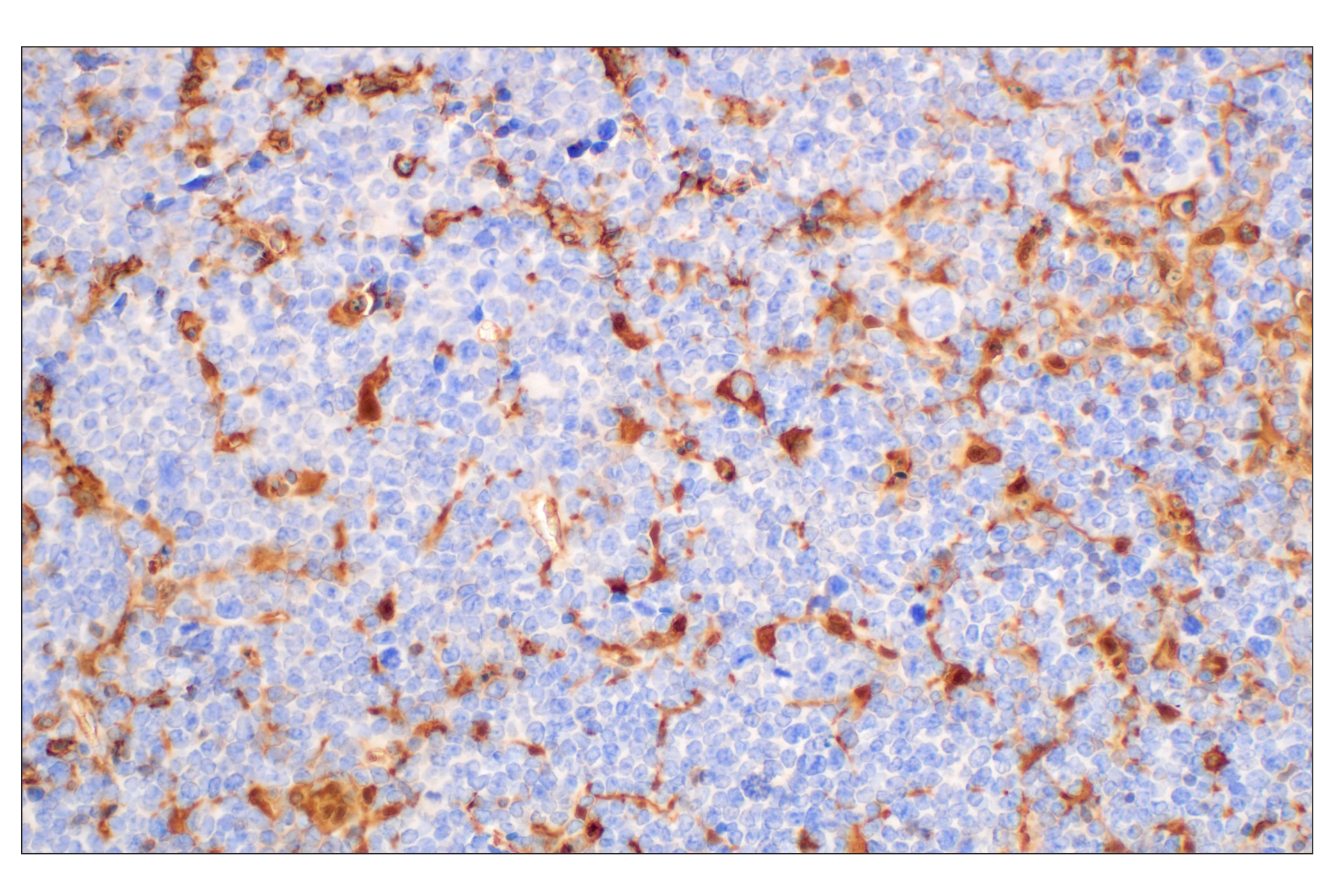 Immunohistochemistry Image 9: Annexin V (E3W8V) Rabbit mAb