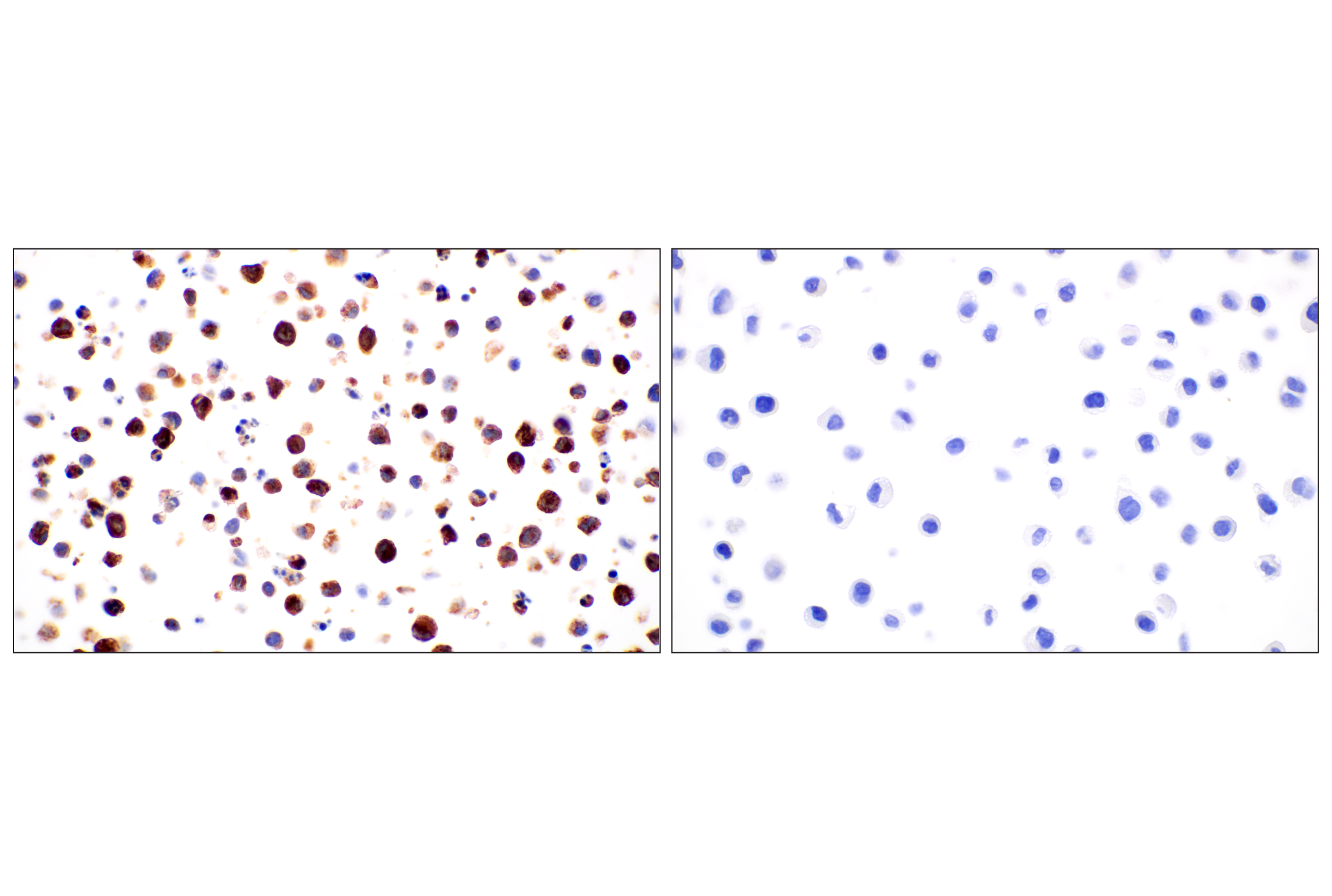 Immunohistochemistry Image 10: Lysozyme C (E9W6E) Rabbit mAb (BSA and Azide Free)