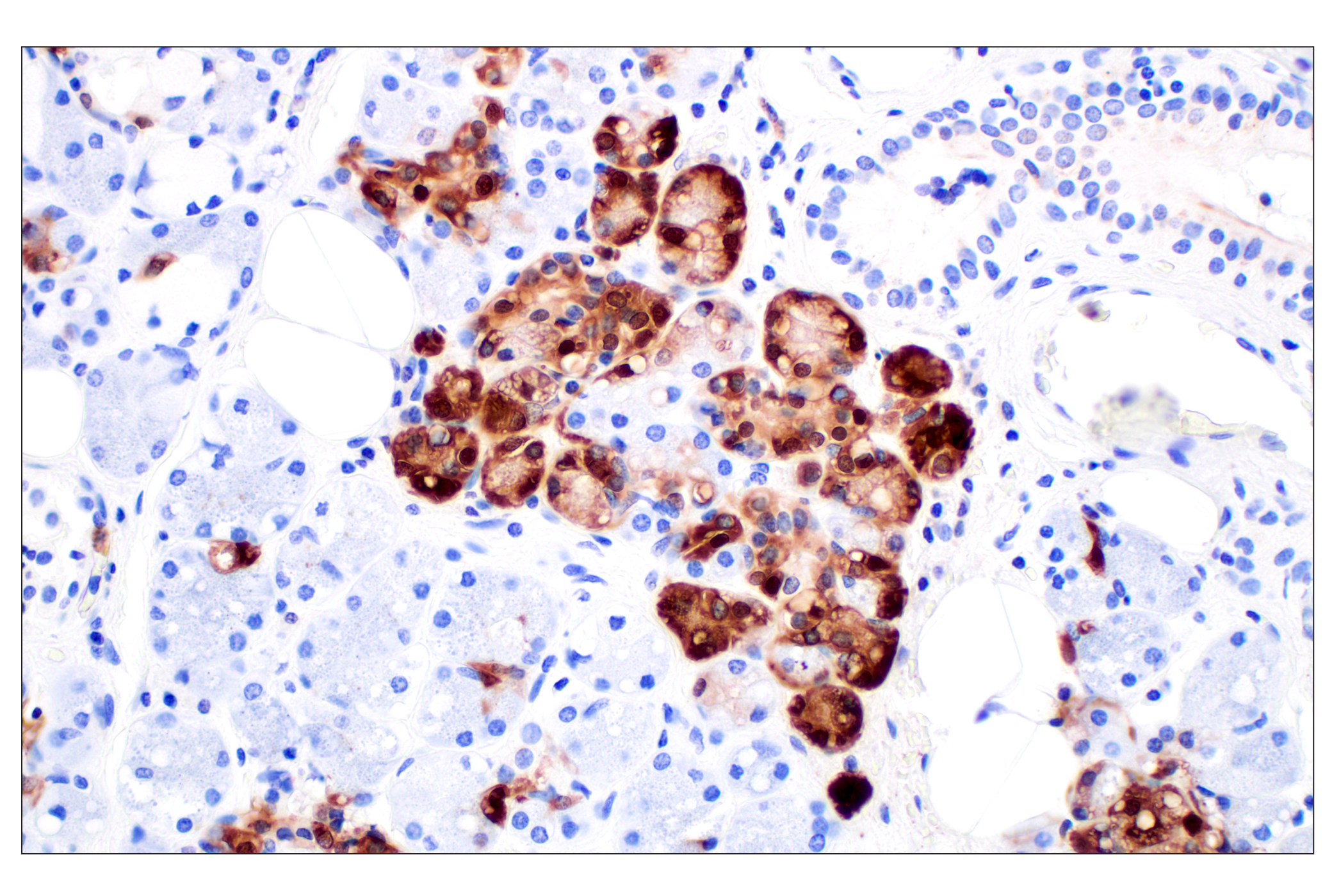Immunohistochemistry Image 8: Lysozyme C (E9W6E) Rabbit mAb (BSA and Azide Free)