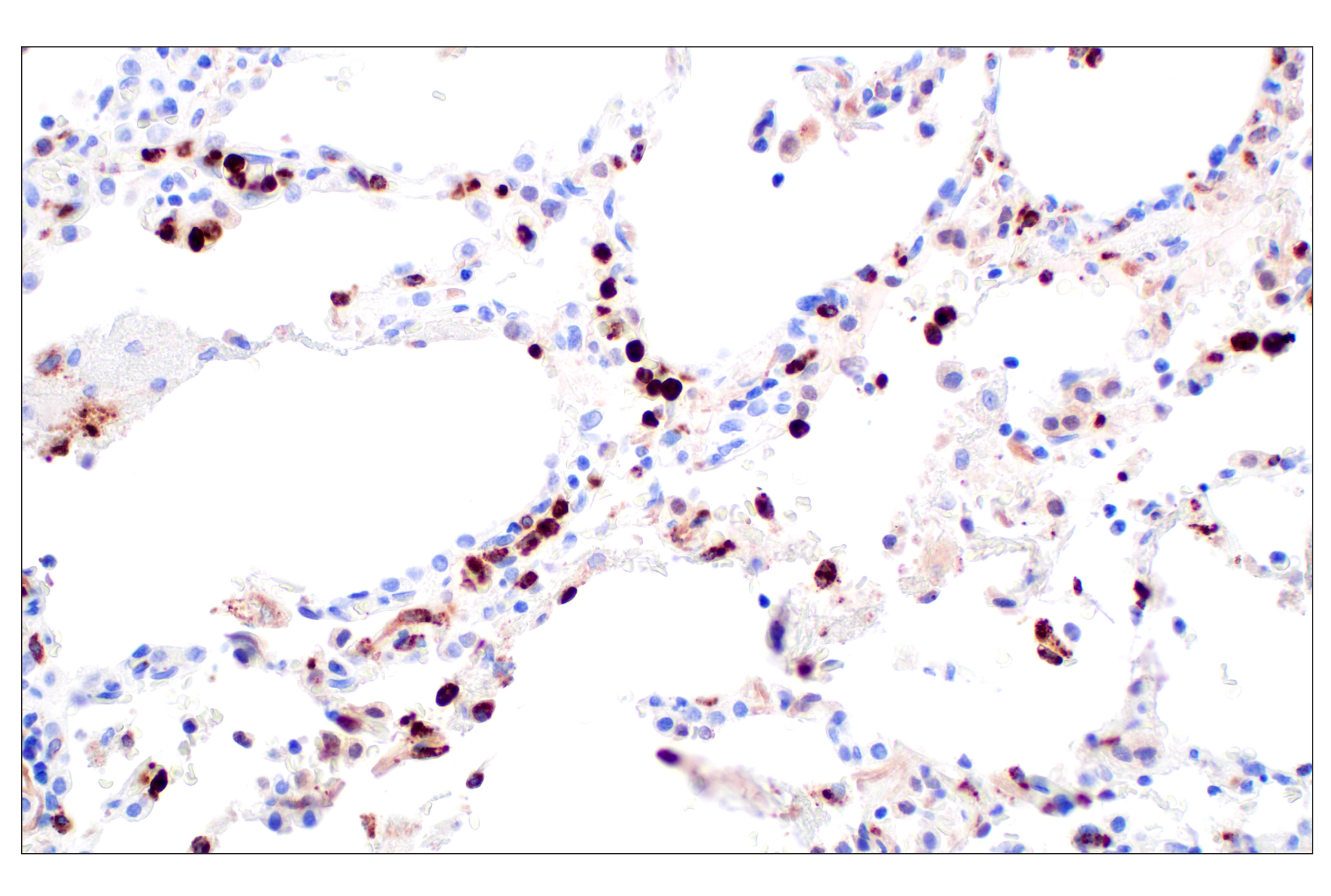 Immunohistochemistry Image 7: Lysozyme C (E9W6E) Rabbit mAb (BSA and Azide Free)