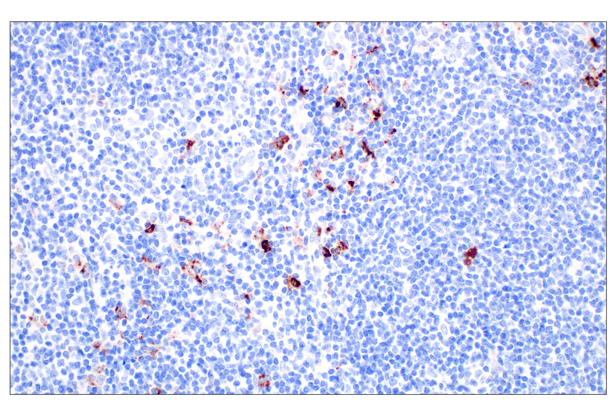 Immunohistochemistry Image 3: Lysozyme C (E9W6E) Rabbit mAb (BSA and Azide Free)