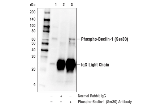 Immunoprecipitation Image 1: Phospho-Beclin-1 (Ser30) Antibody