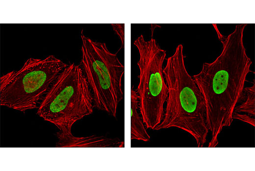 Immunofluorescence Image 1: Acetyl-Histone H2B (Lys12) Antibody