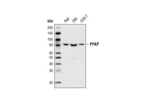 Western Blotting Image 1: PFKP Antibody