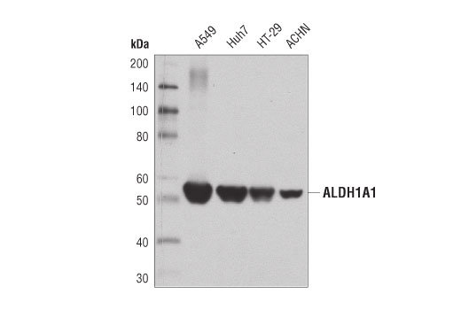 Western Blotting Image 1: ALDH1A1 (D9Q8E) XP® Rabbit mAb