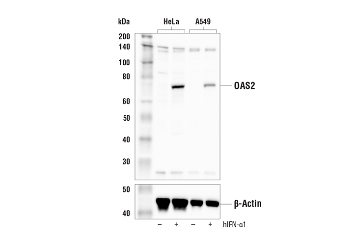 Western Blotting Image 1: OAS2 Antibody