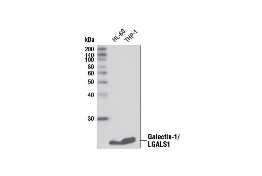 Western Blotting Image 1: Galectin-1/LGALS1 Antibody