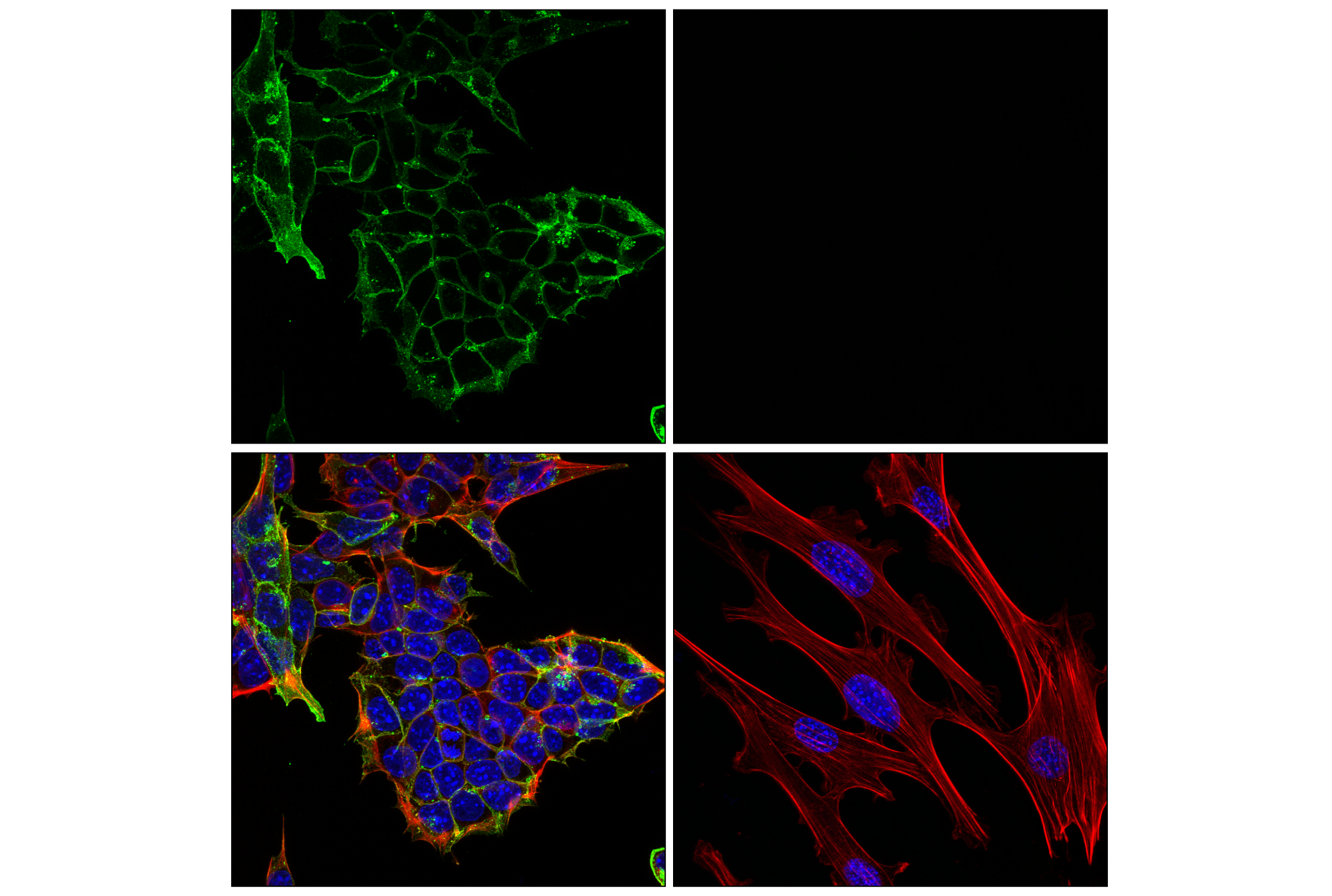 Immunofluorescence Image 1: CD15/SSEA1 (MMA) Mouse mAb