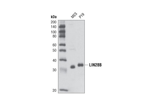 Western Blotting Image 1: LIN28B Antibody