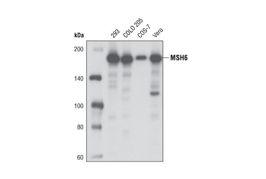  Image 4: Mismatch DNA Repair (MMR) Antibody Sampler Kit