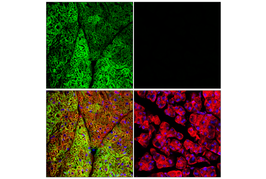 Immunofluorescence Image 1: UCP1 (E9Z2V) XP® Rabbit mAb (Alexa Fluor® 488 Conjugate)