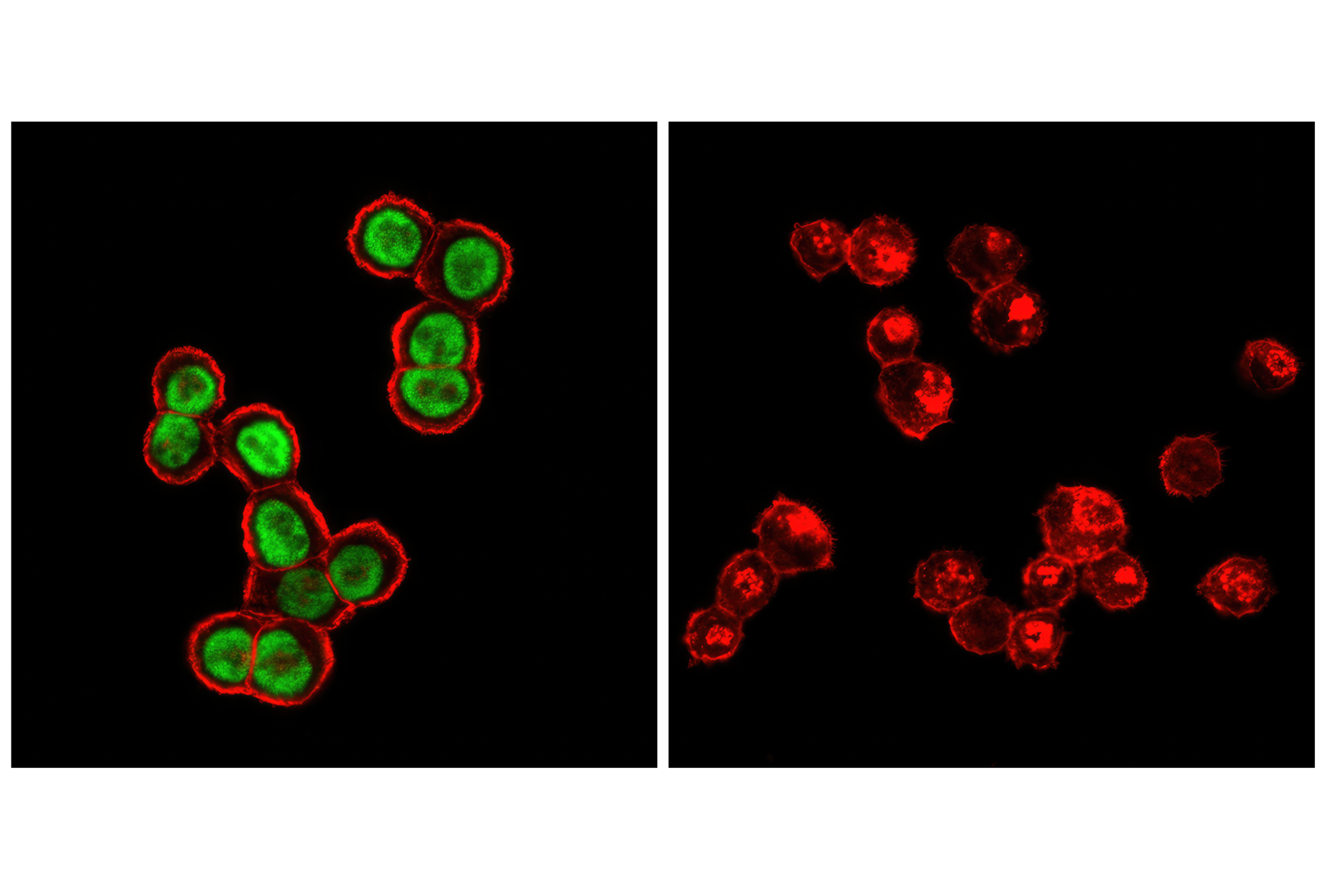 Immunofluorescence Image 1: p53 (7F5) Rabbit mAb (Alexa Fluor® 488 Conjugate)