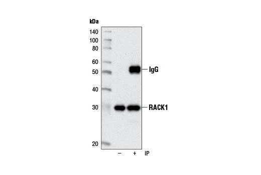 Immunoprecipitation Image 1: RACK1 (D59D5) Rabbit mAb