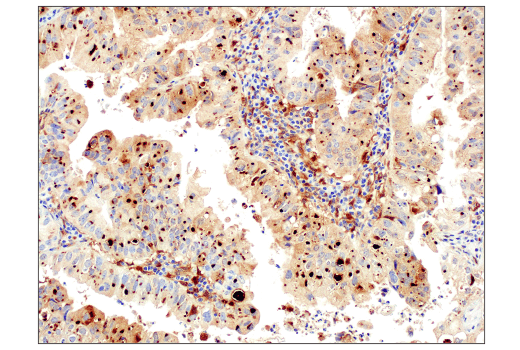 Immunohistochemistry Image 1: Galectin-9 (D9R4A) XP® Rabbit mAb (BSA and Azide Free)