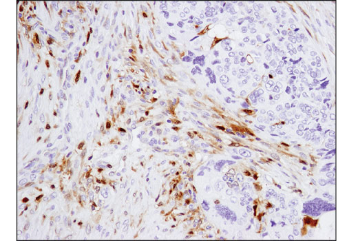 Immunohistochemistry Image 4: Galectin-9 (D9R4A) XP® Rabbit mAb (BSA and Azide Free)