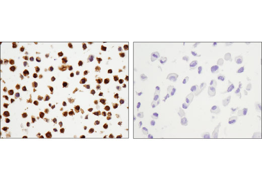 Immunohistochemistry Image 5: Galectin-9 (D9R4A) XP® Rabbit mAb (BSA and Azide Free)