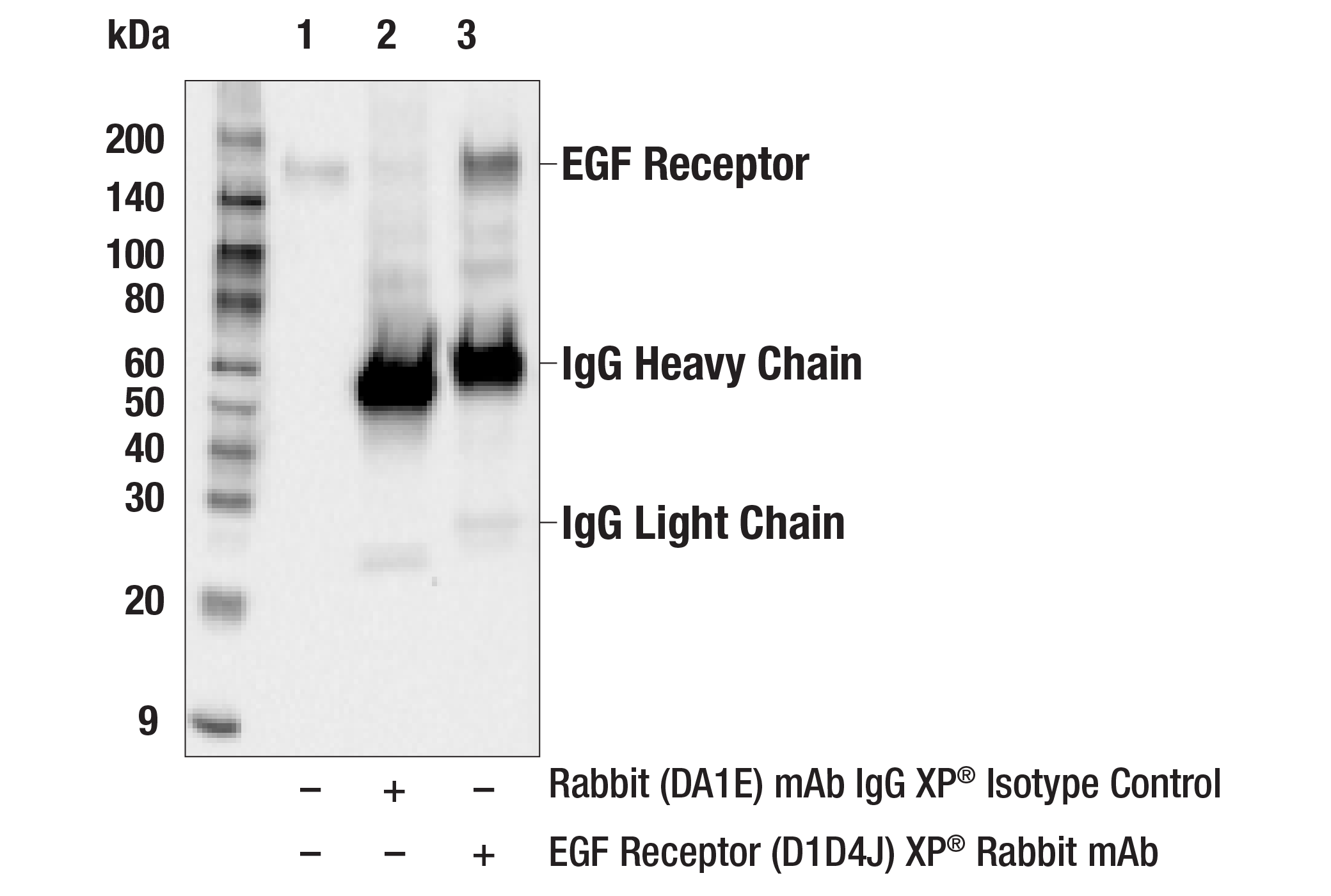 Immunoprecipitation Image 1: EGF Receptor (D1D4J) XP® Rabbit mAb