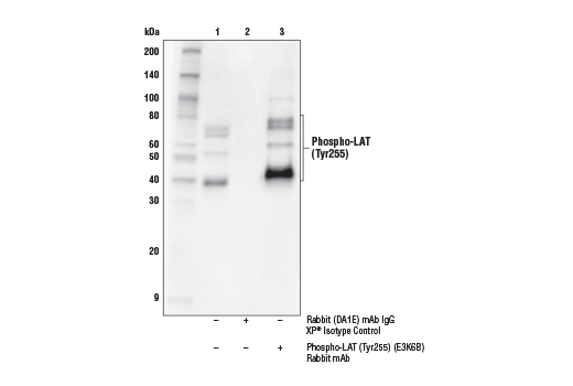 Immunoprecipitation Image 1: Phospho-LAT (Tyr255) (E3K6B) Rabbit mAb