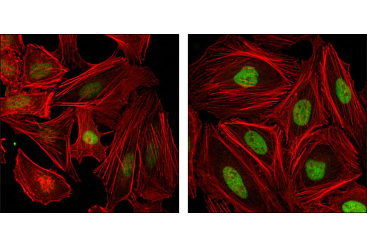 Immunofluorescence Image 1: FoxM1 (D12D5) XP® Rabbit mAb