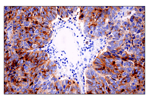 Immunohistochemistry Image 5: CD10/Neprilysin (E5P7S) Rabbit mAb (BSA and Azide Free)