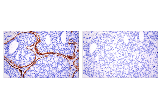 Immunohistochemistry Image 2: CD10/Neprilysin (E5P7S) Rabbit mAb (BSA and Azide Free)