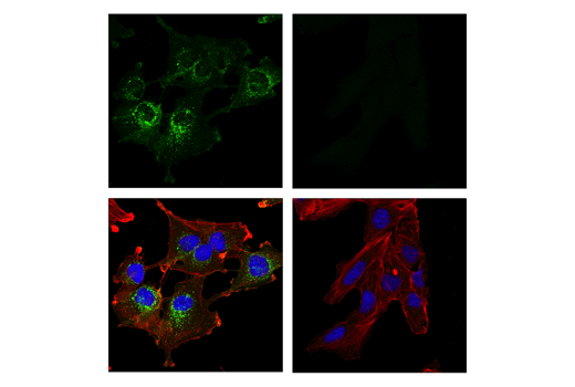 Immunofluorescence Image 1: CD10/Neprilysin (E5P7S) Rabbit mAb (BSA and Azide Free)