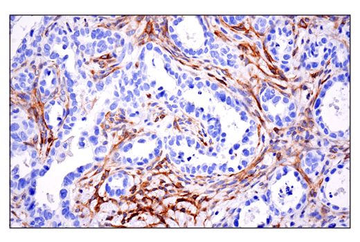 Immunohistochemistry Image 6: CD10/Neprilysin (E5P7S) Rabbit mAb (BSA and Azide Free)