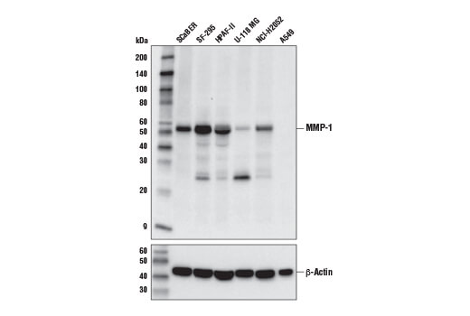  Image 10: ECM Profiling Antibody Sampler Kit