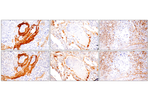 Immunohistochemistry Image 2: MMP-1 (E9S9N) Rabbit mAb