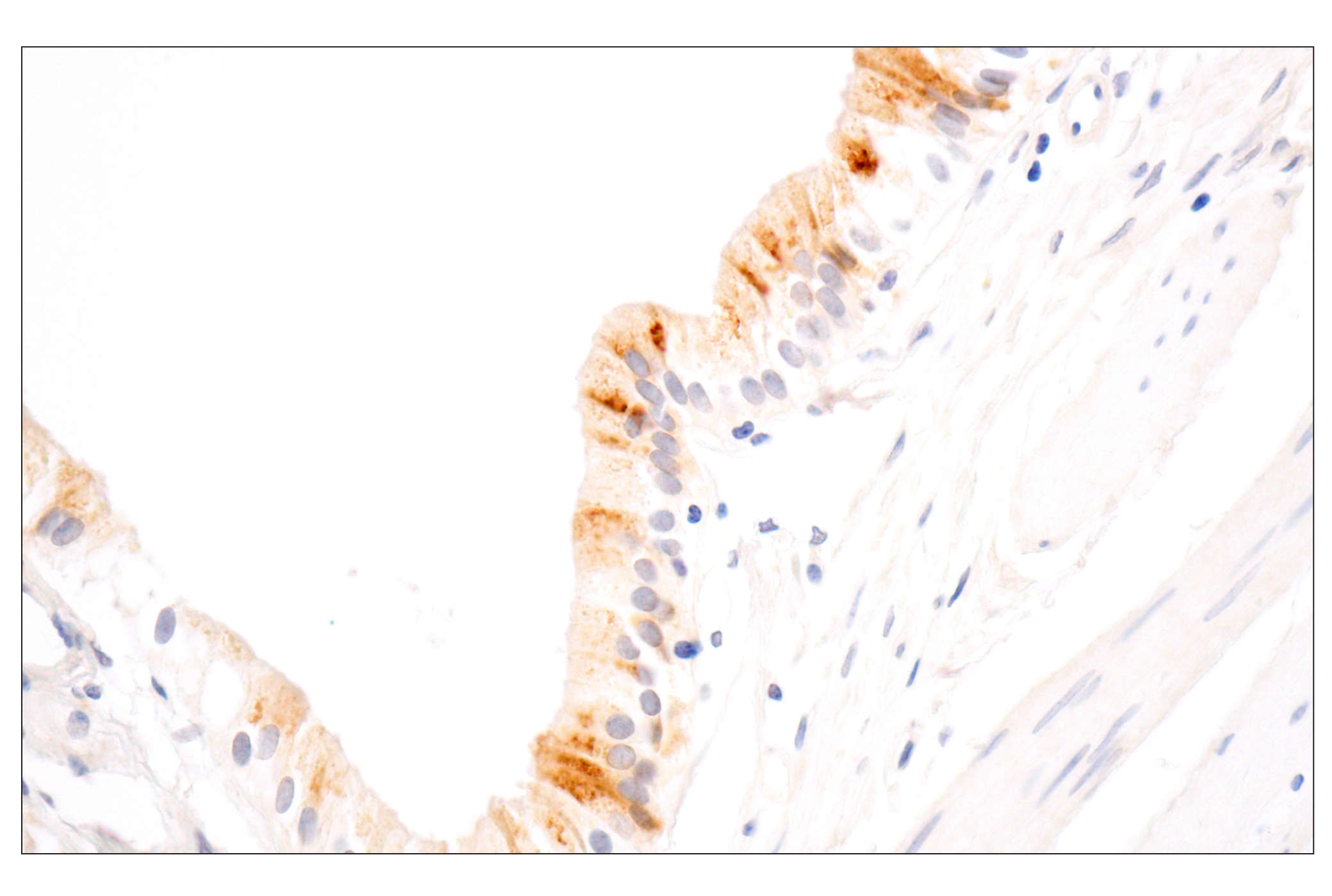 undefined Image 24: ECM Profiling Antibody Sampler Kit