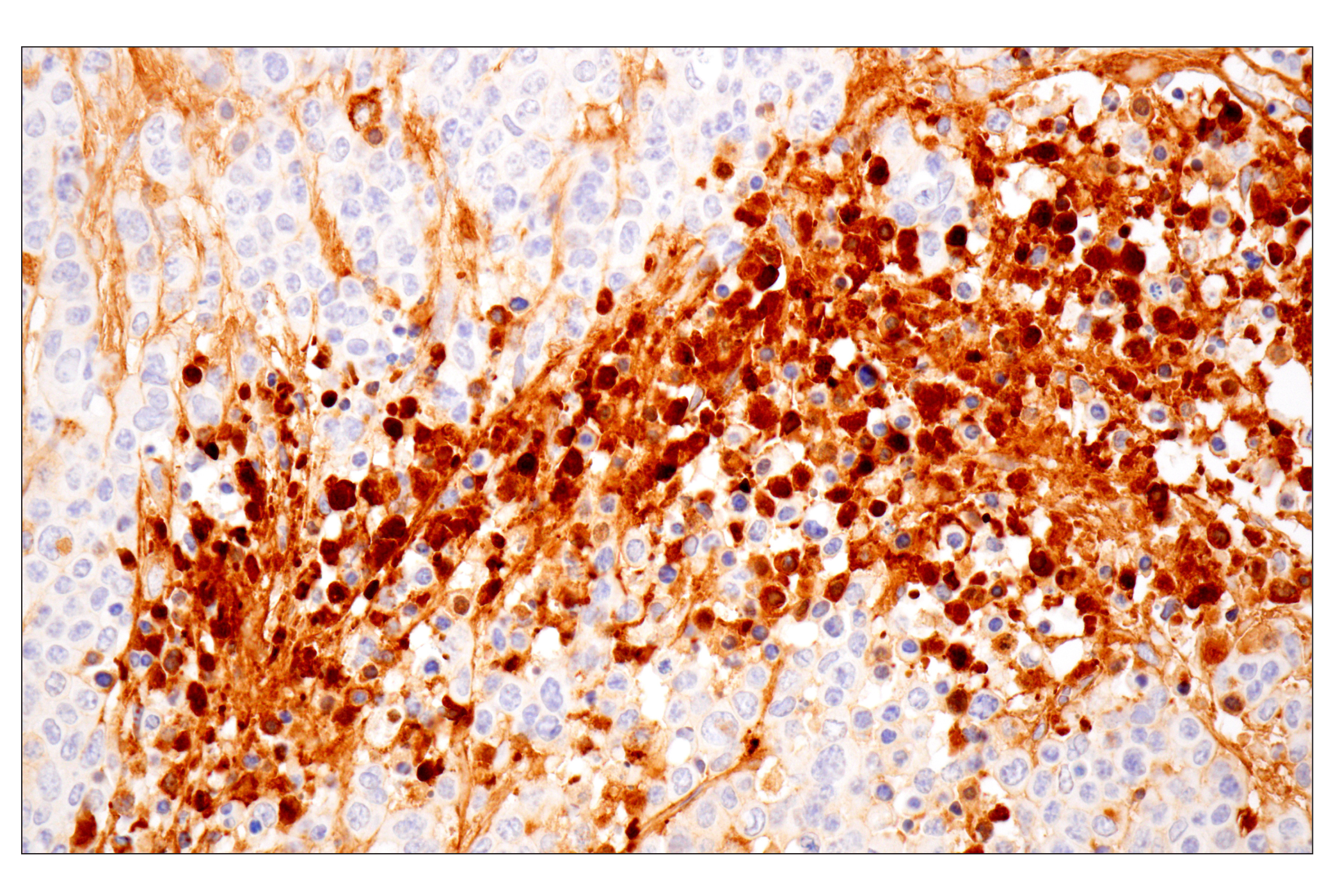 undefined Image 6: ECM Profiling Antibody Sampler Kit