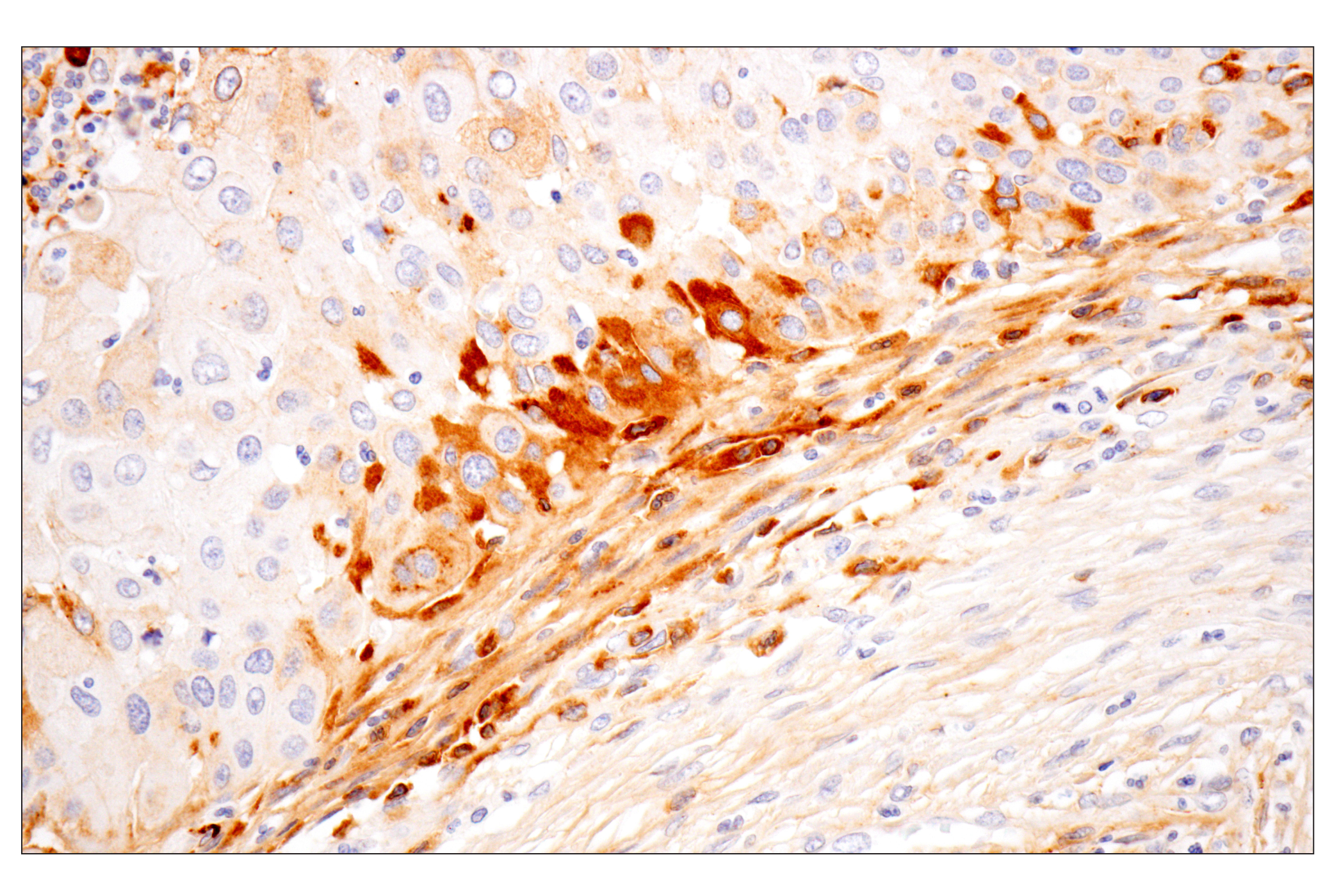 undefined Image 20: ECM Profiling Antibody Sampler Kit