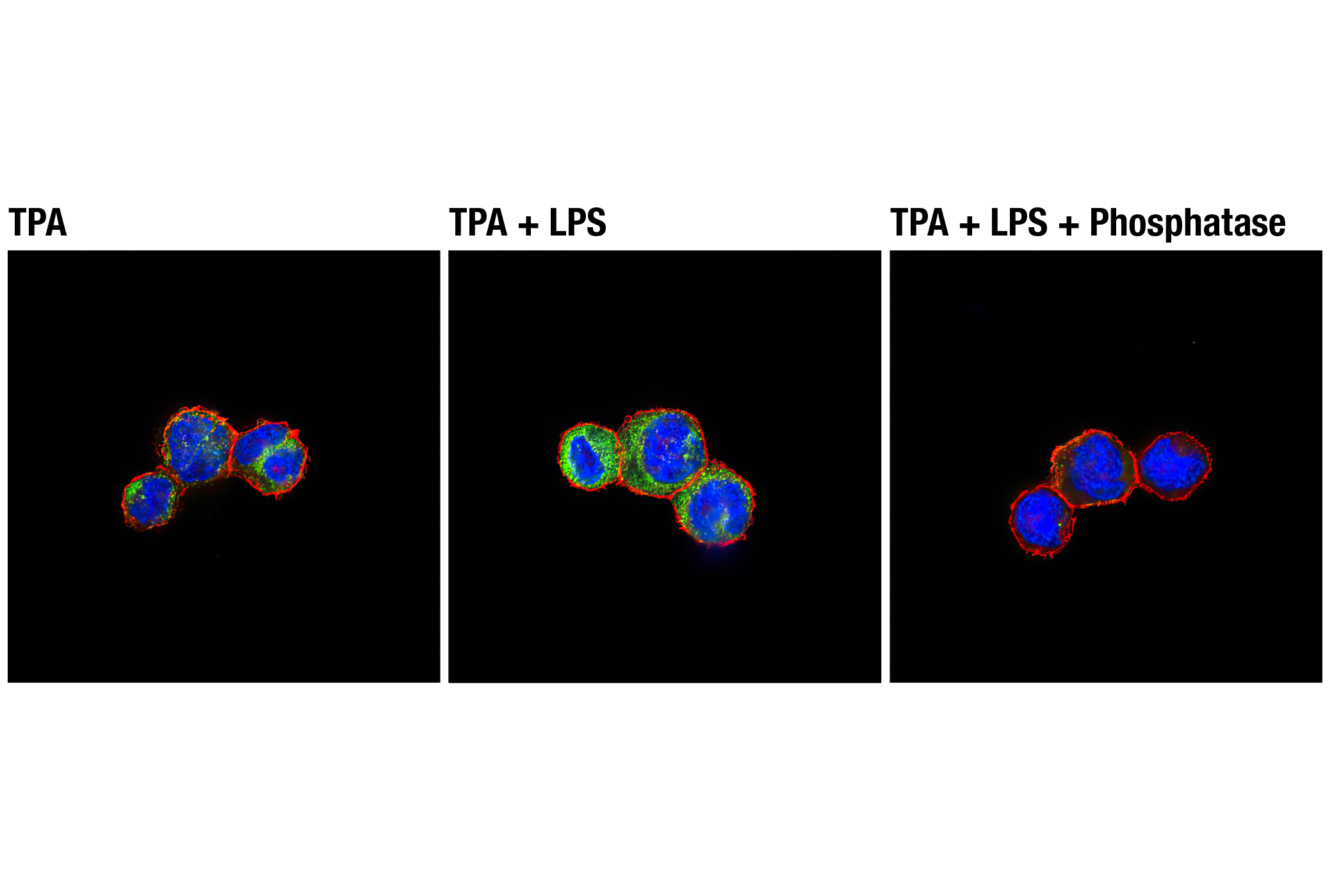 Immunofluorescence Image 1: Phospho-TBK1/NAK (Ser172) (D52C2) XP® Rabbit mAb (BSA and Azide Free)