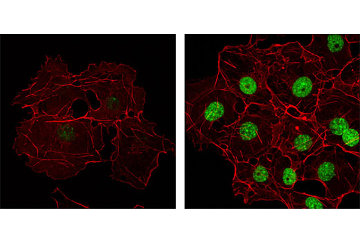 Immunofluorescence Image 1: Phospho-Histone H2A.X (Ser139/Tyr142) Antibody