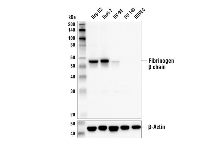 Western Blotting Image 1: Fibrinogen beta chain Antibody