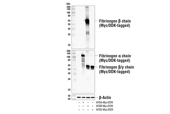Western Blotting Image 2: Fibrinogen beta chain Antibody