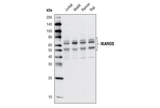 Western Blotting Image 1: Ikaros Antibody