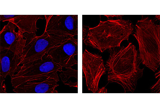 Immunofluorescence Image 1: Nanog (D73G4) XP® Rabbit mAb (Alexa Fluor® 647 Conjugate)