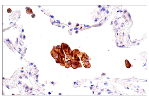 Immunohistochemistry Image 9: Transferrin Receptor/CD71 (10F11) Mouse mAb