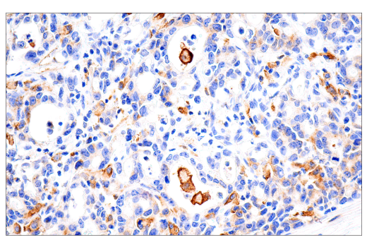 Immunohistochemistry Image 3: Transferrin Receptor/CD71 (10F11) Mouse mAb