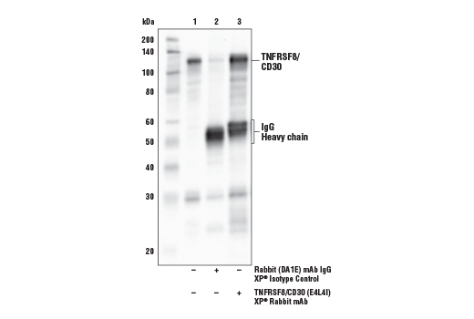 Immunoprecipitation Image 1: TNFRSF8/CD30 (E4L4I) XP® Rabbit mAb