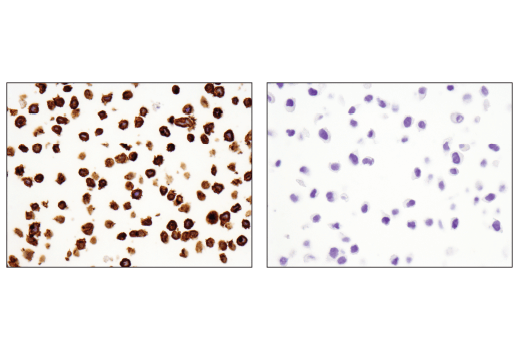 Immunohistochemistry Image 8: TNFRSF8/CD30 (E4L4I) XP® Rabbit mAb